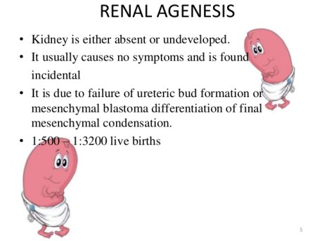 congenital-anomalies-of-renal-system-5-638